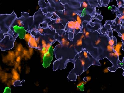 Abb. 01 Immunzell Interaktionen im Krebsgewebe